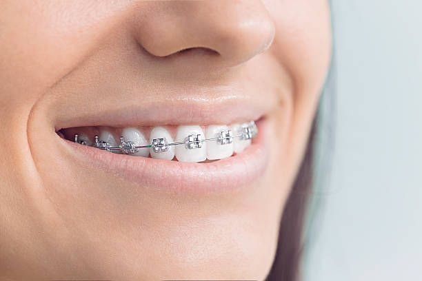 Best Invisalign and Clear Aligners  in Henderson, NC